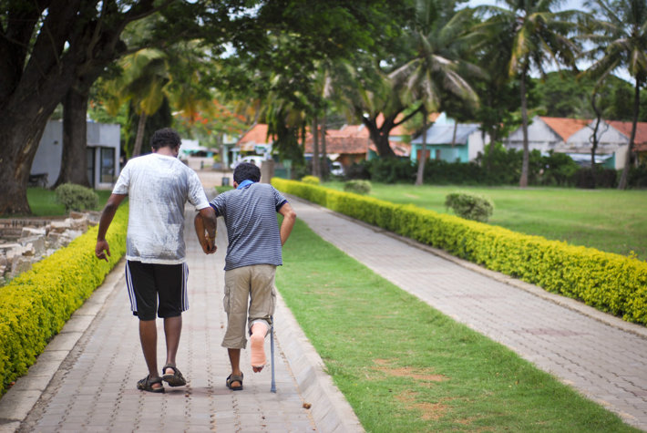 Man helping another man walk with cast and crutch