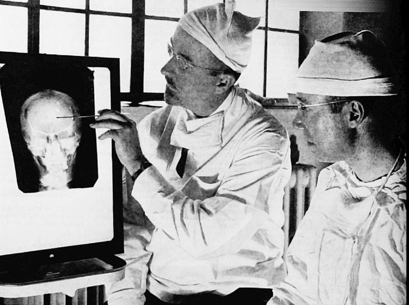Doctors pointing to an xray of the brain